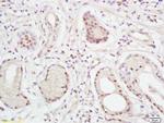 XPC Antibody in Immunohistochemistry (Paraffin) (IHC (P))