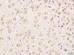 XPC Antibody in Immunohistochemistry (Paraffin) (IHC (P))