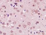 XPC Antibody in Immunohistochemistry (Paraffin) (IHC (P))