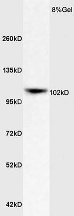 ApoER2 Antibody in Western Blot (WB)