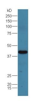 Adenosine deaminase Antibody in Western Blot (WB)