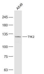 TYK2 Antibody in Western Blot (WB)