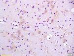 CaI-PLA2 Antibody in Immunohistochemistry (Paraffin) (IHC (P))