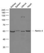 Netrin 4 Antibody in Western Blot (WB)