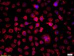 THRSP Antibody in Immunocytochemistry (ICC/IF)