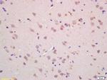 CHAC1 Antibody in Immunohistochemistry (Paraffin) (IHC (P))