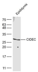 CIDEC Antibody in Western Blot (WB)