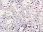 MUM1 Antibody in Immunohistochemistry (Paraffin) (IHC (P))