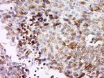 MAGEB3 Antibody in Immunohistochemistry (Paraffin) (IHC (P))