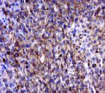 MAGEB6 Antibody in Immunohistochemistry (Paraffin) (IHC (P))