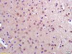 PDCD10 Antibody in Immunohistochemistry (Paraffin) (IHC (P))