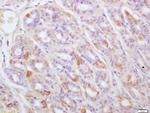 TPST1 Antibody in Immunohistochemistry (Paraffin) (IHC (P))