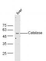 Catalase Antibody in Western Blot (WB)