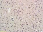 SCN3B Antibody in Immunohistochemistry (Paraffin) (IHC (P))