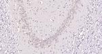 STK40 Antibody in Immunohistochemistry (Paraffin) (IHC (P))