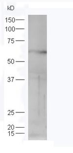 STK40 Antibody in Western Blot (WB)