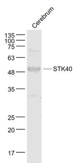 STK40 Antibody in Western Blot (WB)