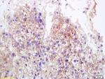 MICA+MICB Antibody in Immunohistochemistry (Paraffin) (IHC (P))