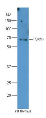 FOXN1 Antibody in Western Blot (WB)