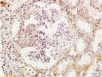 Wilms Tumor Protein Antibody in Immunohistochemistry (Paraffin) (IHC (P))