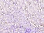 Wilms Tumor Protein Antibody in Immunohistochemistry (Paraffin) (IHC (P))