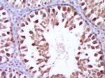 Wilms Tumor Protein Antibody in Immunohistochemistry (Paraffin) (IHC (P))