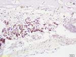 RNF43 Antibody in Immunohistochemistry (Paraffin) (IHC (P))