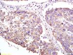 XAGE2 Antibody in Immunohistochemistry (Paraffin) (IHC (P))