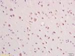 IFNAR2 Antibody in Immunohistochemistry (Paraffin) (IHC (P))