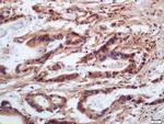 Phospho-MYL9 (Ser20) Antibody in Immunohistochemistry (Paraffin) (IHC (P))