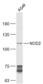 NOD2 Antibody in Western Blot (WB)