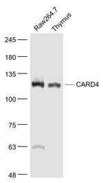 CARD4 Antibody in Western Blot (WB)