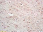 SEPT4 Antibody in Immunohistochemistry (Paraffin) (IHC (P))