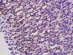 PNPT1 Antibody in Immunohistochemistry (Paraffin) (IHC (P))