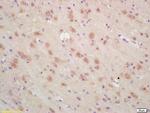 ARP3 Antibody in Immunohistochemistry (Paraffin) (IHC (P))