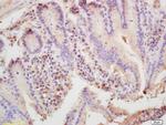 ARP3 Antibody in Immunohistochemistry (Paraffin) (IHC (P))