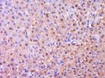 NGFR Antibody in Immunohistochemistry (Paraffin) (IHC (P))