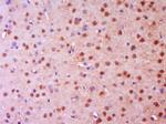 NGFR Antibody in Immunohistochemistry (Paraffin) (IHC (P))