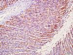 MUC5AC Antibody in Immunohistochemistry (Paraffin) (IHC (P))