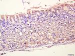 MUC5AC Antibody in Immunohistochemistry (Paraffin) (IHC (P))