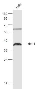 Islet-1 Antibody in Western Blot (WB)