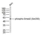 Phospho-Smad2 (Ser250) Antibody in Western Blot (WB)