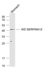 SERPINA12 Antibody in Western Blot (WB)