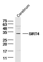 SIRT4 Antibody in Western Blot (WB)