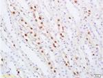 ZHX2 Antibody in Immunohistochemistry (Paraffin) (IHC (P))