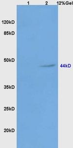 Galactosidase alpha Antibody in Western Blot (WB)