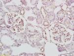 STK3+STK4 Antibody in Immunohistochemistry (Paraffin) (IHC (P))