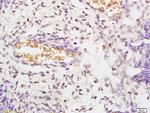 STK3+STK4 Antibody in Immunohistochemistry (Paraffin) (IHC (P))