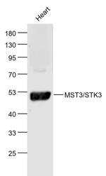 STK3+STK4 Antibody in Western Blot (WB)