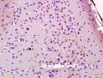 JMY Antibody in Immunohistochemistry (Paraffin) (IHC (P))